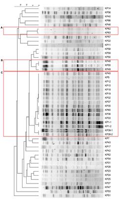 Transmission Dynamics of Carbapenem-Resistant Klebsiella pneumoniae Sequence Type 11 Strains Carrying Capsular Loci KL64 and rmpA/rmpA2 Genes